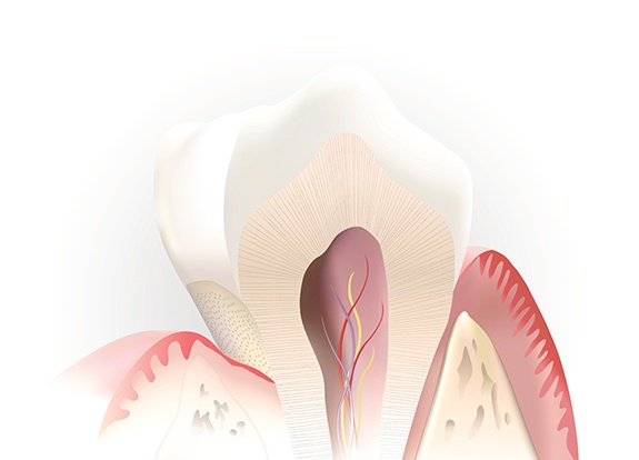 Inside of tooth after pulp therapy