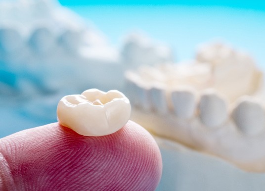 Dental crown on fingertip with model jaw in background