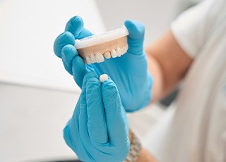 Dentist placing sample crown over model abutment tooth