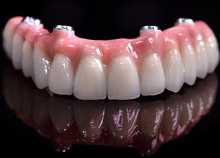 Full dentures made to be attached to dental implants in Grand Prairie, TX