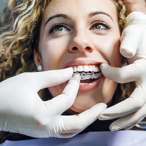 Young woman getting Invisalign in Grand Prairie for teeth grinding