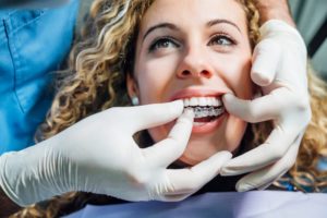 a woman with her dentist working on an Invisalign treatment plan